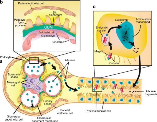Schematic representation of events underlying progressive glomerular and tubulointerstitial injury of