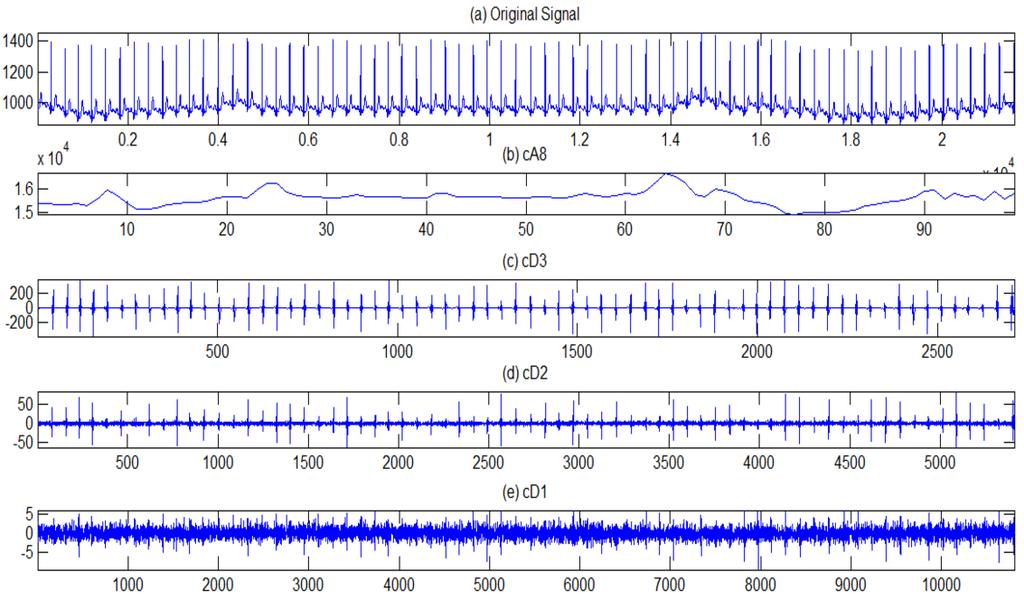 Y. Xia et al. / Quick detection of QRS complexes and R-waves using a wavelet transform and K-means clustering S1061 electrocardiogram from 00:17:00 to 00:18:00.