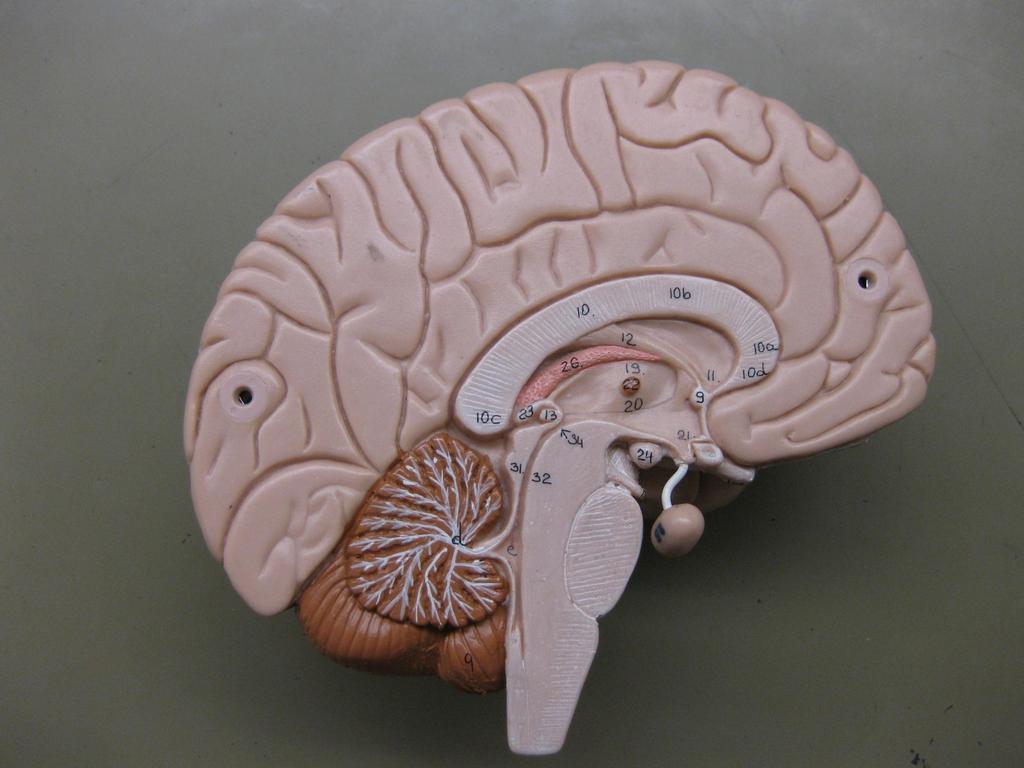Third ventricle Cerebral aqueduct