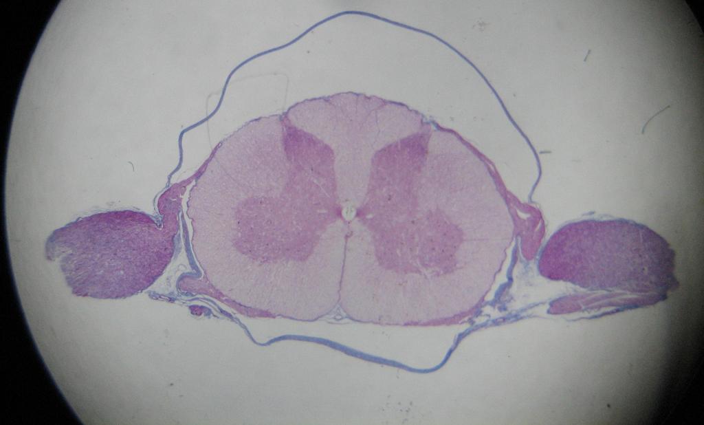 Posterior median sulcus Dorsal root ganglion Central canal Dorsal root Dorsal horn Ventral horn