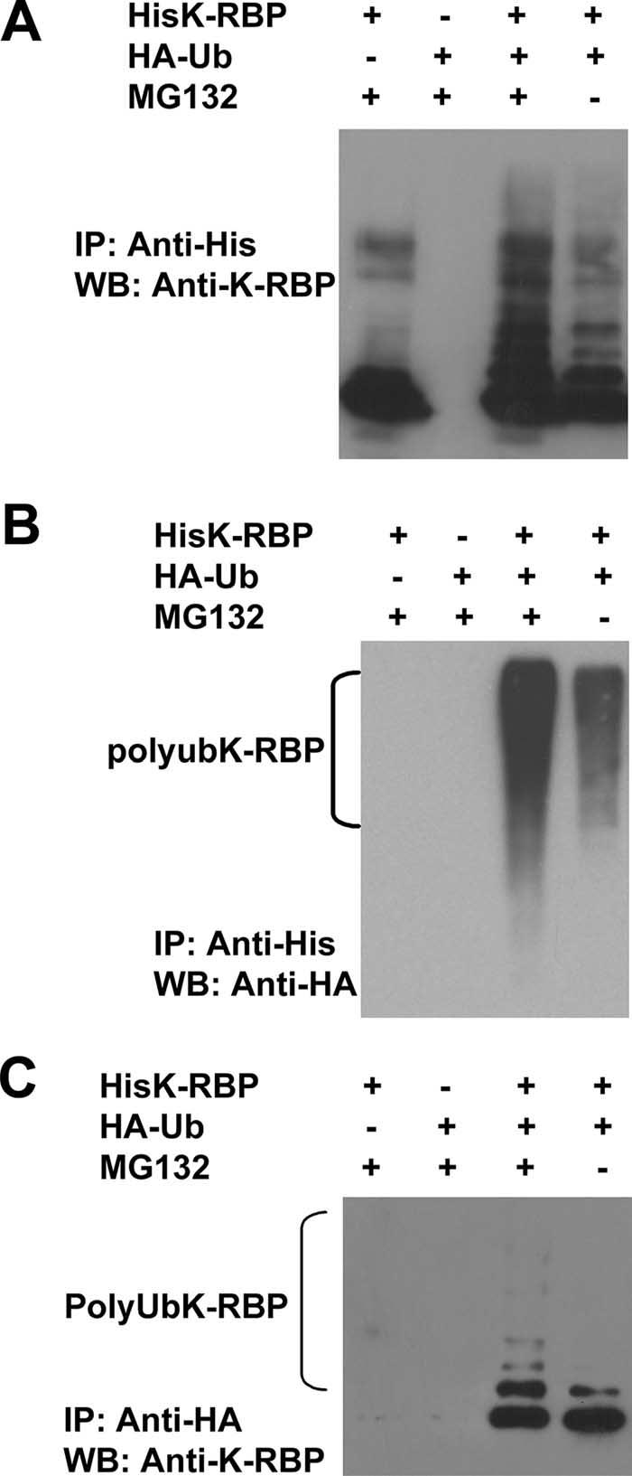 The cell lysates were prepared and immunoblotted with anti-k-rbp (top), anti-rta (middle), or anti- -tubulin (bottom) antibodies.