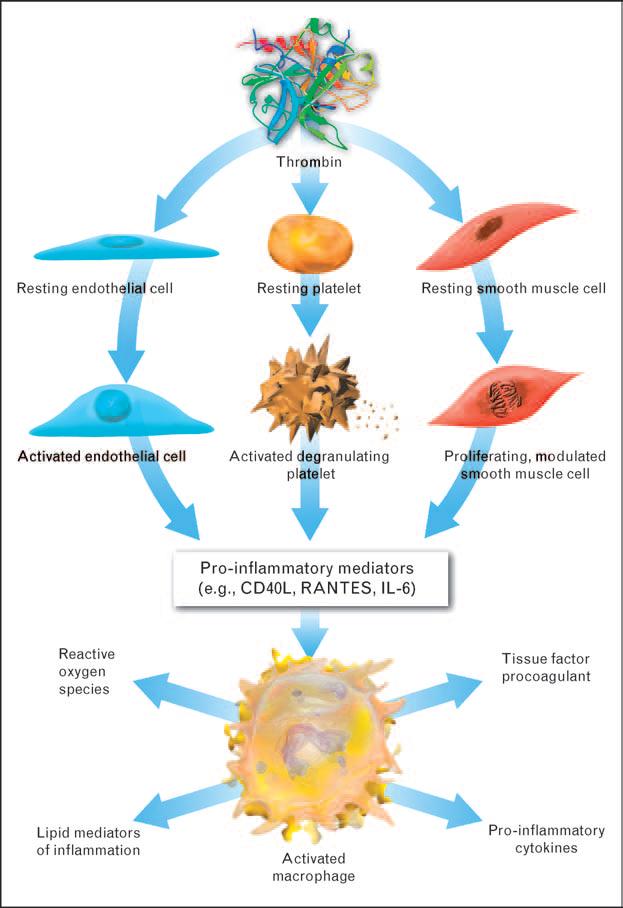 THROMBIN- INDUCED INFLAMMATION LEADS TO THROMBOSIS (Croce K, Libby P. Intertwining of thrombosis and inflammation in atherosclerosis.
