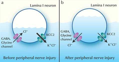 KCC2 and NKCC1 Cl transporters set neuronal Cl i and thus the direction of GABA gated Cl currents GABA is