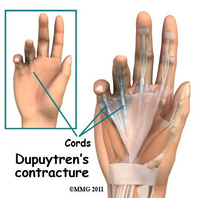 be sensitive to touch. For this reason many patients are worried that something serious is wrong with their hand. Diagnosis How do doctors identify the problem?