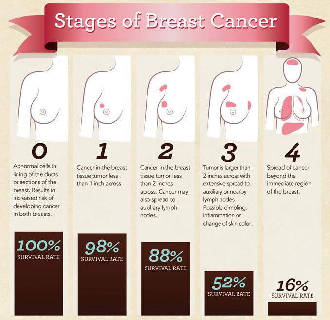 Early Stage Breast Cancer by NCI definition is all