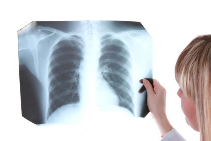 What is tuberculosis? TB is an infectious disease that usually affects the lungs. It is the second greatest killer due to a single infectious agent worldwide, and in 2012, 1.