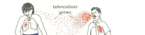 Stages of Tuberculosis Exposure to