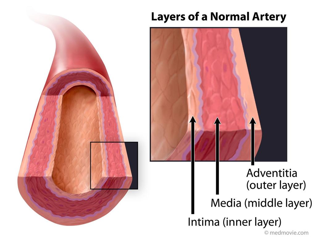Question 6 Which of the following is NOT a tissue layer of an artery?