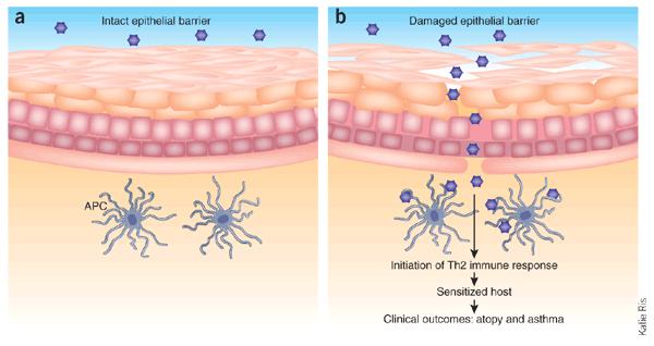 An intact epithelial barrier (a) prevents allergens from reaching antigen-presenting cells (APCs) in subepithelial