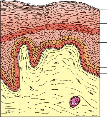 (b) Diagram of the layers of the epidermis of horse skin. Source: Stashak & Theoret 2014. 9 Reproduced with permission of Elsevier. appendages, and a microvascular and lymphatic system.
