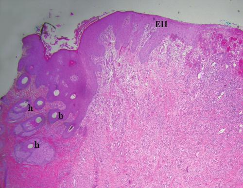 8 Equine Wound Management epithelialization cannot proceed until a bed of granulation tissue has formed.