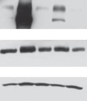 a) 8 MG CHX CFTR Band C EGFR -actin CFTR protein expression band C intensity, % of time h condition 7 6 5 MG CHX 8 Time h 8 Time h c) d) EGFR protein expression % of time h condition 5 5 5 5 NS