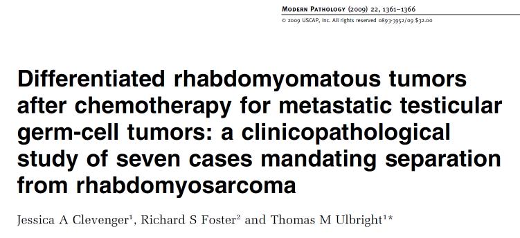 Patients with a sarcoma in the metastases have a higher risk of dying - 7 cases with differentiated skeletal muscle but no primitive cells or mitotic figures - All had a history of a NSGCT, 5 with a