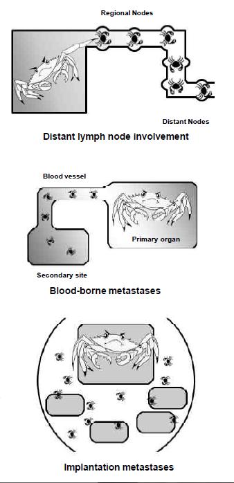 Distant Summary Stage Code 7 Distant lymph nodes Further contiguous extension: Cartilage Bone Skeletal muscle Metastasis Skin