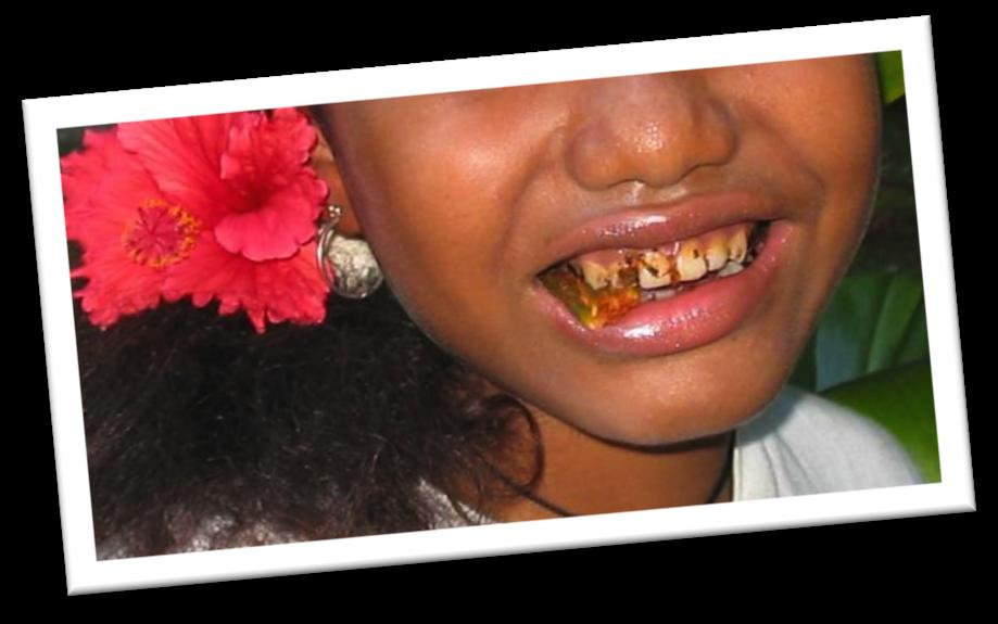 TOBACCO USE AND CHEWING, PALAU YOUTH Key Findings The 2009 PYTS reveals some startling findings about tobacco use among youth aged 13-15 years in the Republic of Palau.