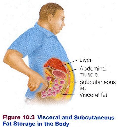 Visceral Fat Risk Heart disease, high blood pressure,