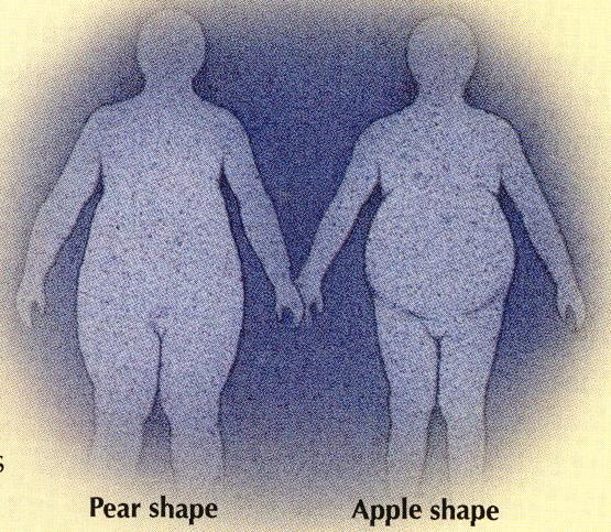 Pear Pattern More fat in hips, thighs, buttocks