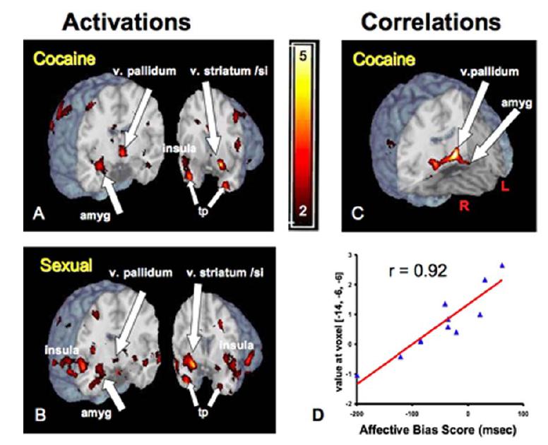 Limbic activation by unseen cues (33 ms) correlate with affectivity Childress, et al PLoS ONE 2007