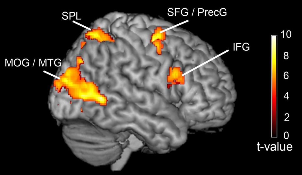 Effects of motion tracking Attention to suprathreshold motion (30%) > color-control condition: No significant effects in the cerebellum (p>0.