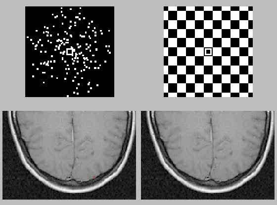 V5 V5 is highly motion sensitive and best localised using a motion localiser stimulus: blocks of moving random dots are compared to blocks of stationary random dots.