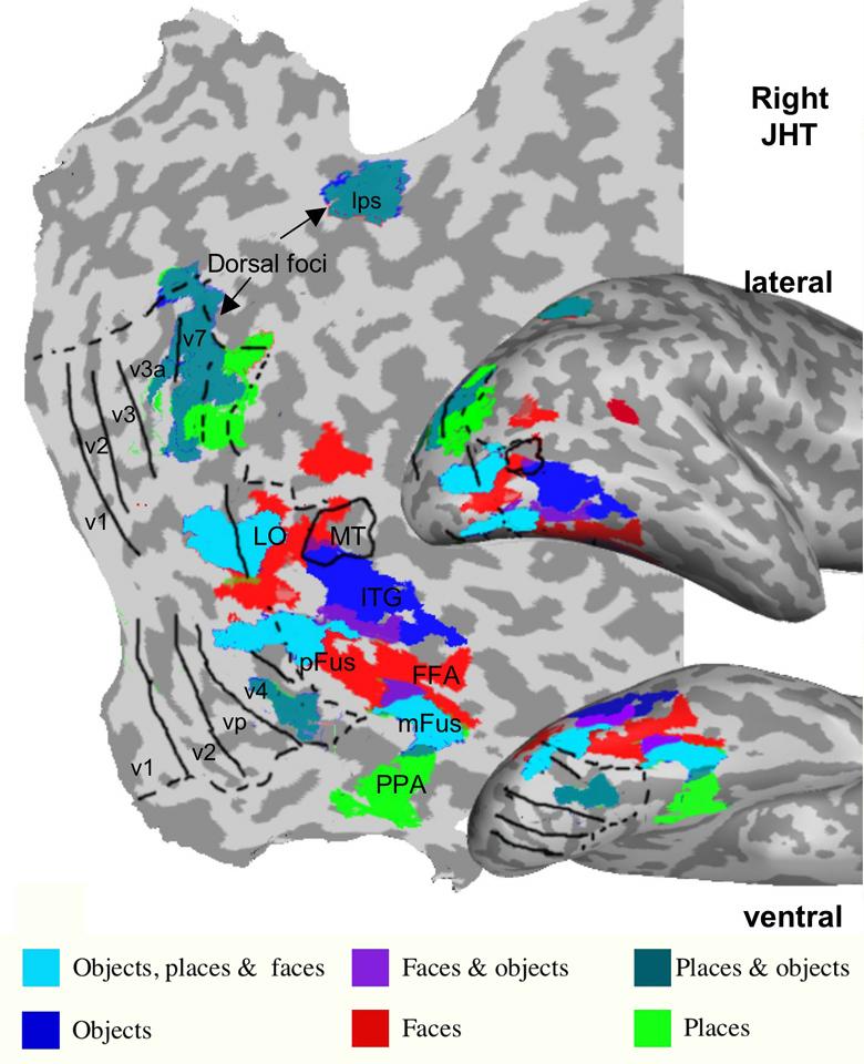 Ventral occipitotemporal cortex contains subregions