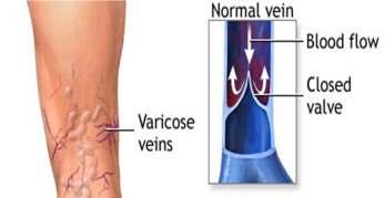 VEINS Blood vessels that carry blood back to the heart are