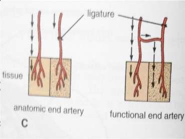 END ARTERIES END ARTERIES: 1.Central artery of retina 2.
