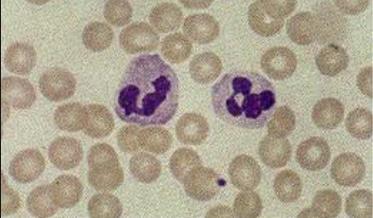 Blood film (smear) to show: Red blood cells, white
