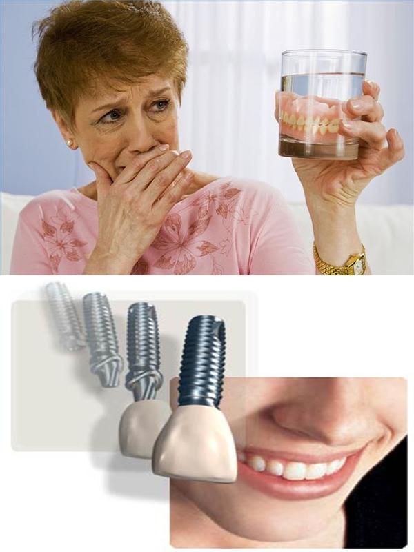 Denture Sufferers Guide Provided By The Dental Spa at Garden City Cary Ganz DDS 300 Garden City