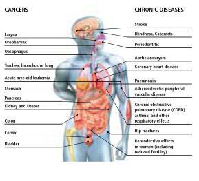 Cardiov ascular Cancer Stroke B rochitis/emphy sema Unintential injuries Diabetes Influenza/pneumonia Alzehimer's disease