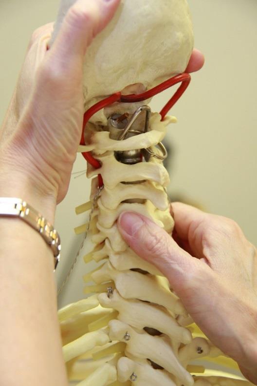 Basic principles of SFR: Typical cervical spine Place the contralateral thumb on the