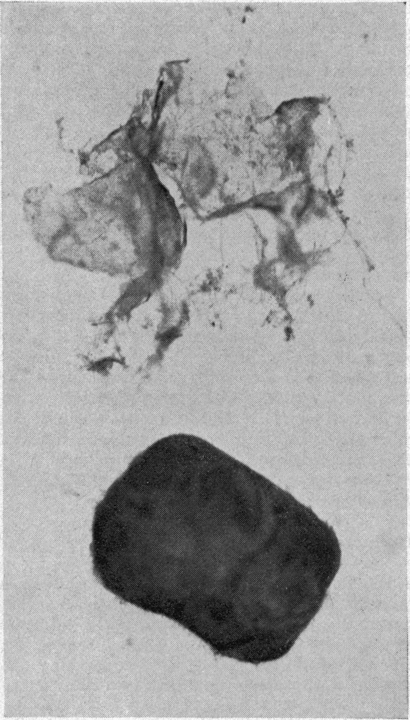 The organic matrix ofgallstones... because *:.,......-. : :present but they were not unambi uously identified ;. not enough material was available to take the 1 anecessary type of x-ray photographs.