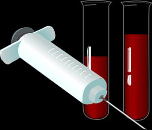 Screening & Testing for HCV Diagnosing HCV infection is a 2 step process 1) Anti-HCV (antibody) o Non