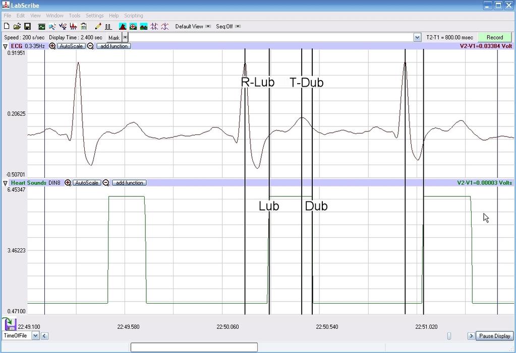Data Analysis 1. Scroll through the recording and find a section of data with four to six exemplary ECG waveforms and consistent responses on the event marker channel, in succession. 2.