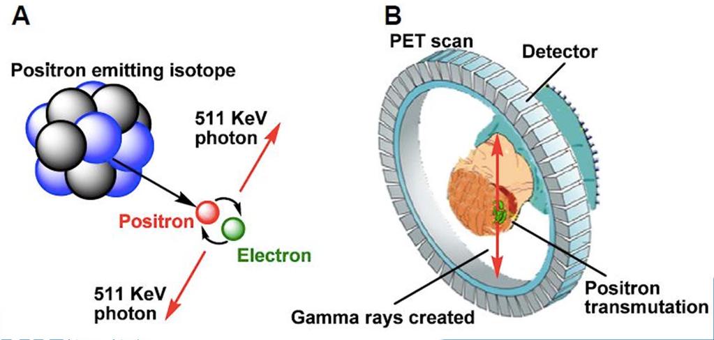 What is a PET Scan Positron Emission