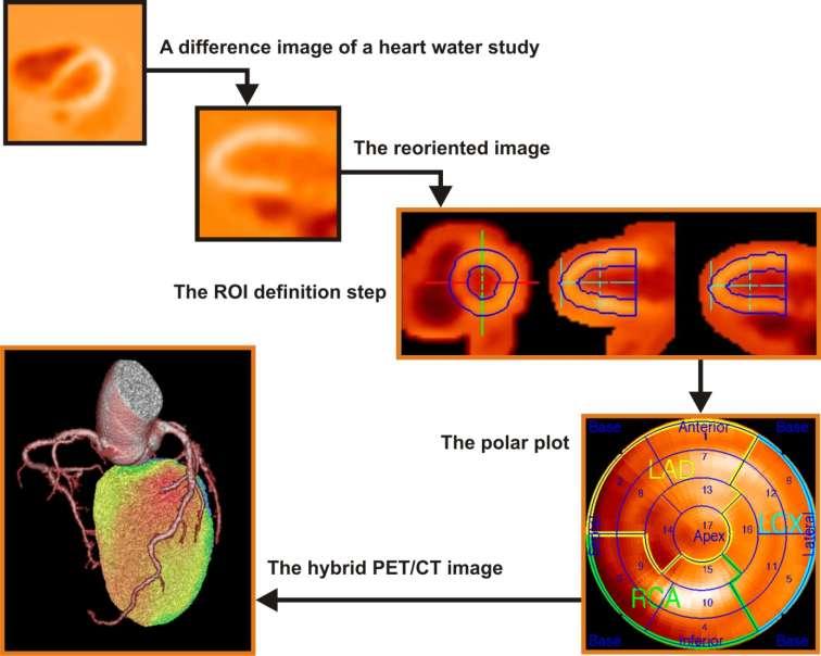 Analysis of dynamic PET Imaging: Complicated?