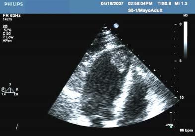 01) be assessed by echocardiography within the first week.