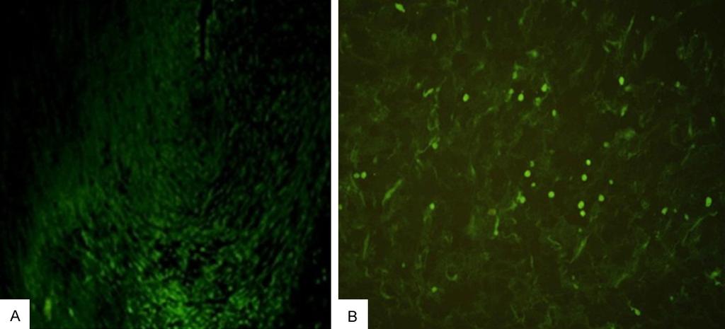 Figure 1. A: Tail vein transplantation group + synthetic E-selectins group (fluorescence microscopy 100 ). There gathers large number of green fluorescence positive cells in the ischemia area.