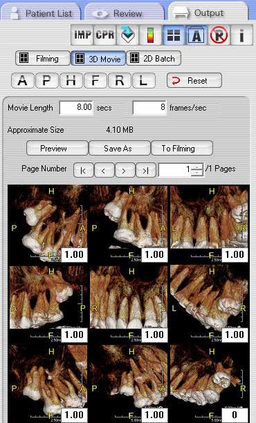 evaluating dedicated 2D Panoramic, 2D Cephalometric, and 3D images.