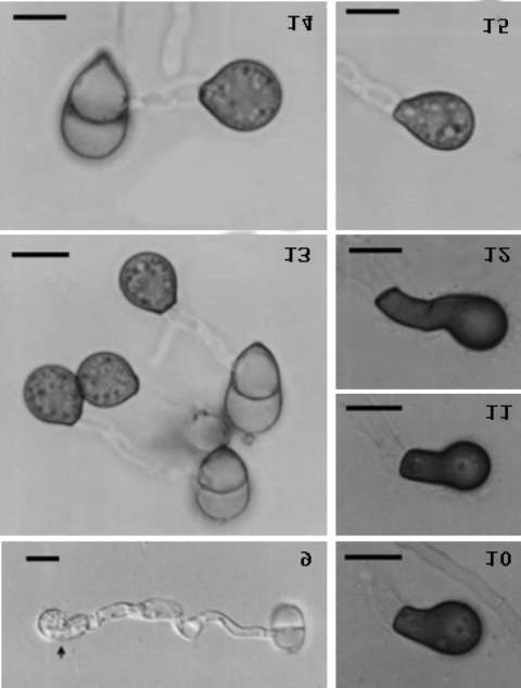 Figs. 9-15. Germ tubes and apressorium formation of Cordana versicolor and C. musae. 9. Germinating conidium of C. versicolor and young boxing-glove-shaped appressorium (arrowed). 10-12.