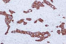 Tissue with epithelial cells Cytokeratin AE1 Catalog No.