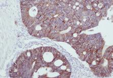 cytoplasm Positive Control Tissue Esophagus, Endometrium EGFR 31G7 Catalog No.