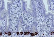 Membrane Positive Control Tissue Lung Cancer LCA