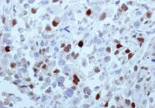60-0045-7 Size RTU 7 ml Staining Pattern No staining Positive Control Tissue N/A