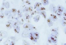 ISH - Detection Kits & Ancillary Reagents In Situ Hybridization Detection Kit Genemed offers highly-sensitive polymer HRP detection systems for CISH applications.