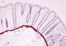 Our primary antibodies are optimized and titrated for immunohistochemistry (IHC) testing using