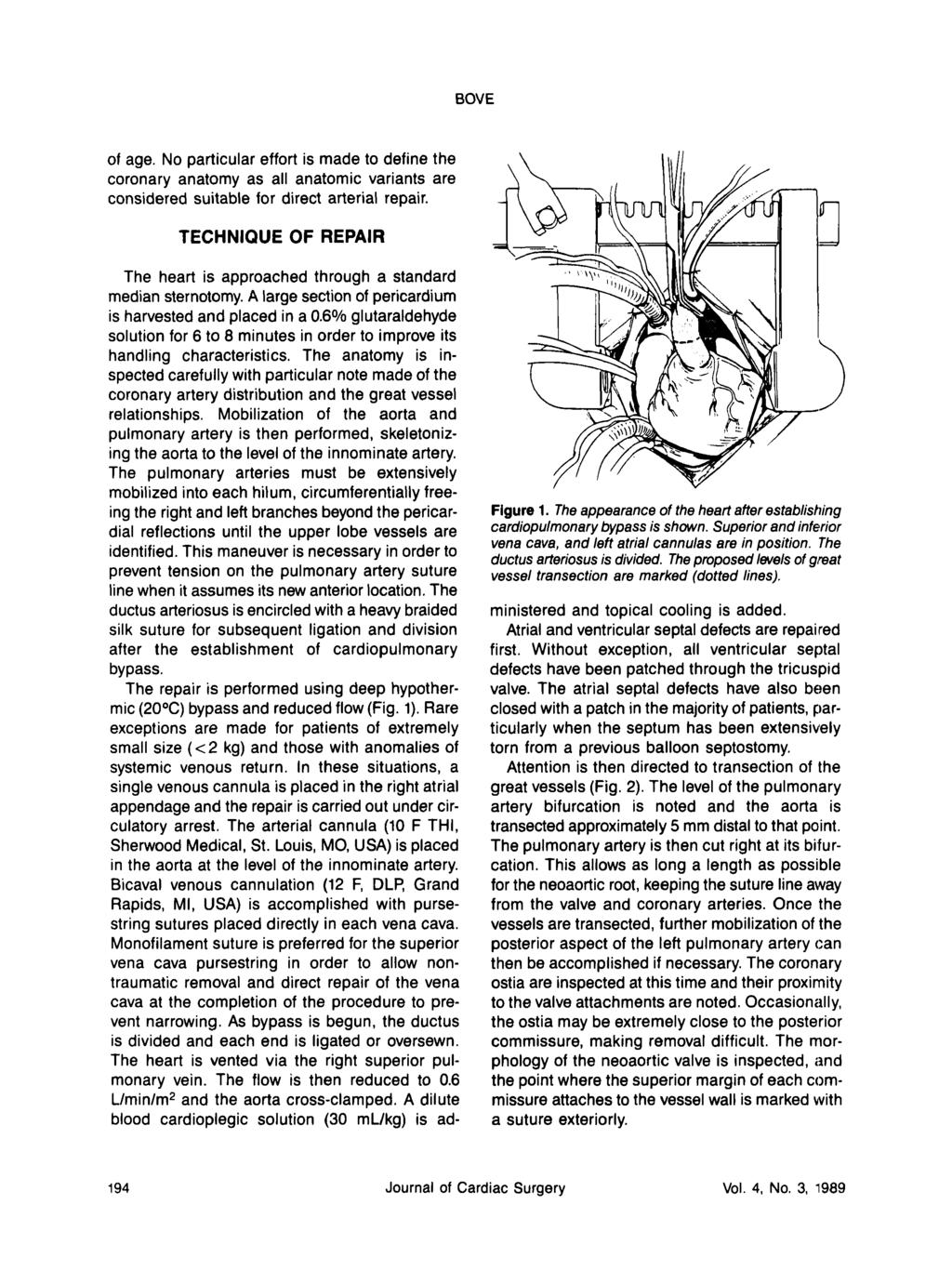 BOVE of age. No particular effort is made to define the coronary anatomy as all anatomic variants are considered suitable for direct arterial repair.