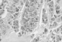 cytoplasm May contain fibrillar matrix with embedded