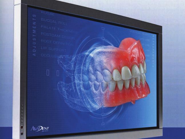 Summary of Advantages of CAD/CAM Complete Dentures! It is possible to record all the clinical information for complete dentures in one appointment (1-2 hours)!