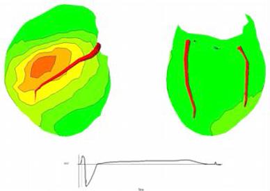 Electrical Mapping of Canine Ventricles http://www.cvrti.utah.edu/?